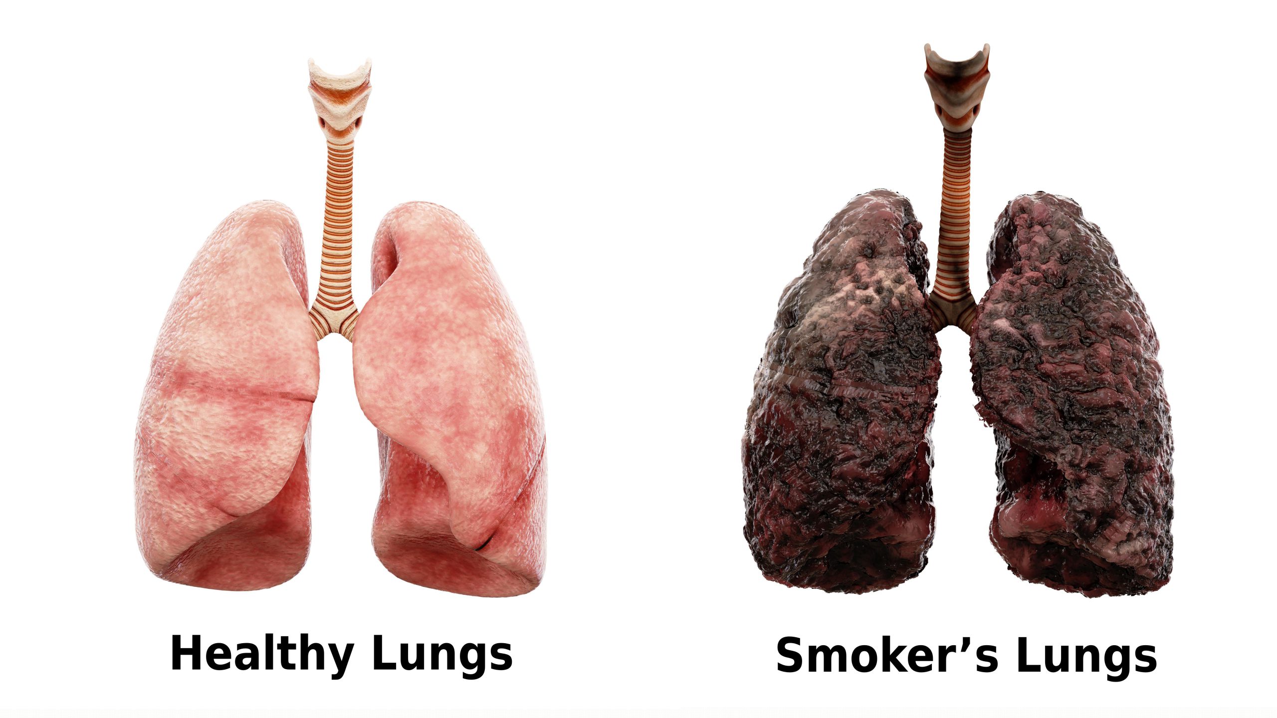 Healthy Lung vs Smoker’s Lung